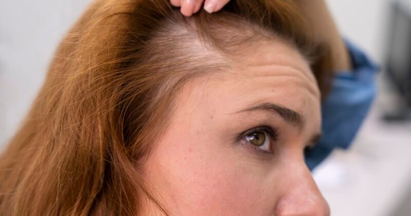 woman-getting-hair-loss-treatment-clinic